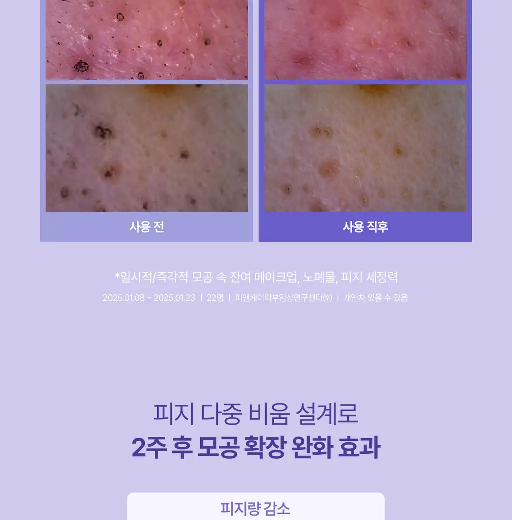 [5월 올영픽/126매 대용량/올리브영 단독] 리쥬란 포어 타이트닝 토너 패드 60매 더블 한정 기획 상세페이지 22